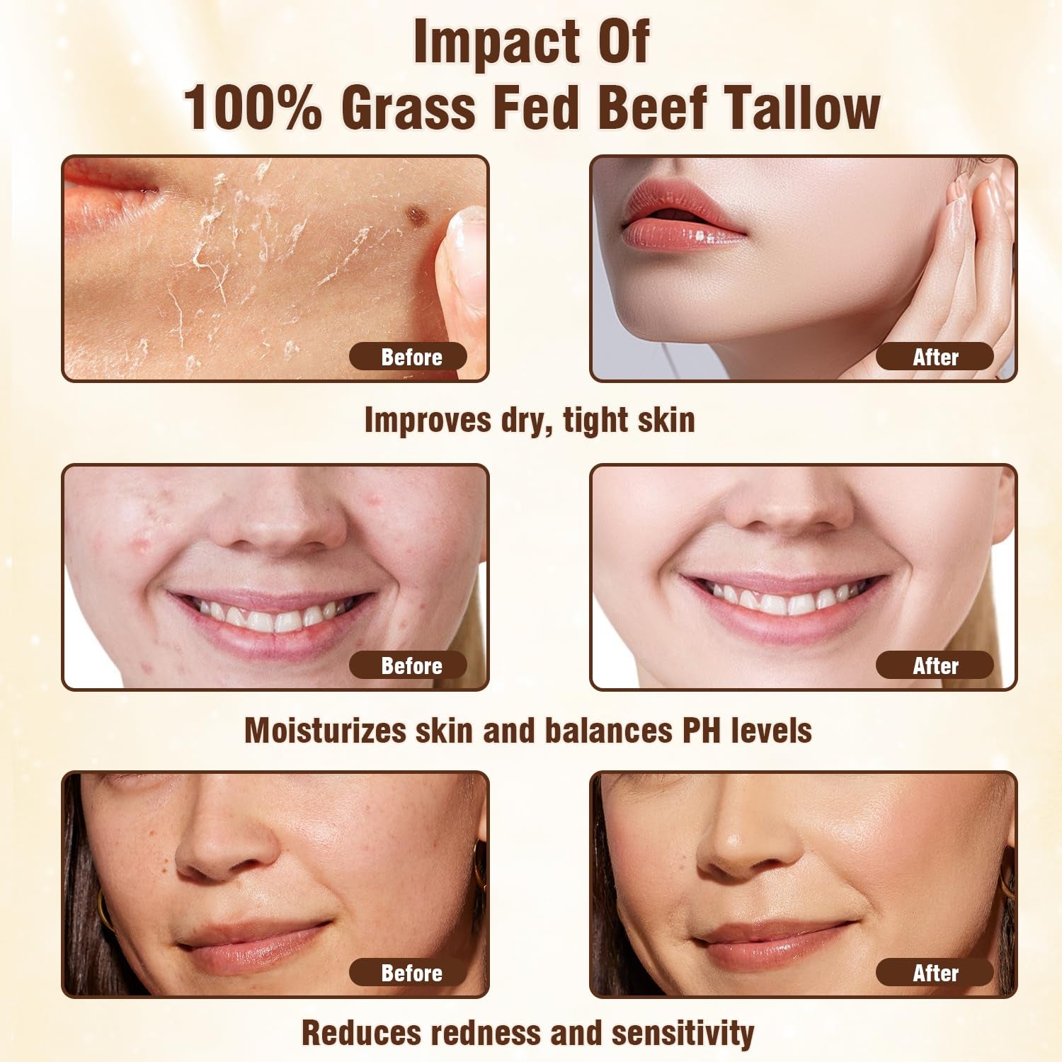 Beef Tallow and Honey Balm - Natural Moisturizing Body Cream for Sensitive Skin, Organic Grass-Fed Beef Tallow